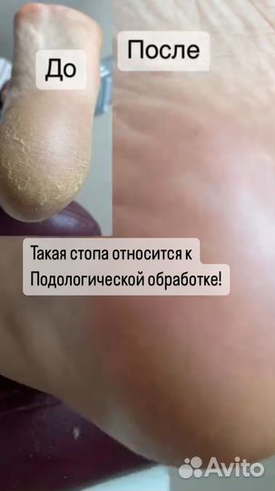 Маникюр, педикюр, подология