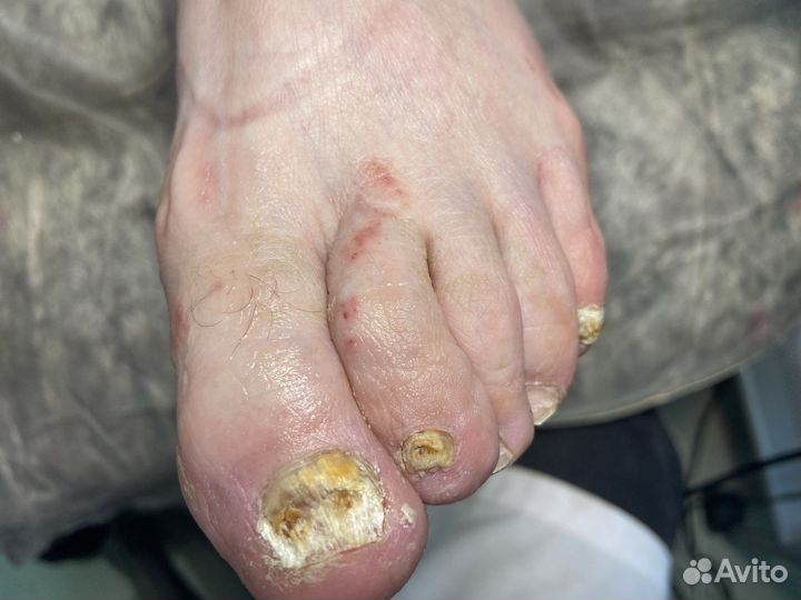 Услуги подолога