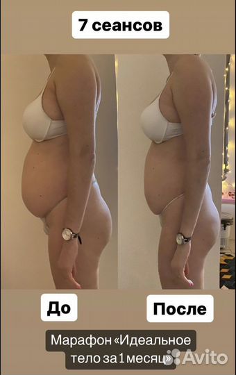 Массаж, коррекция фигуры, активное похудение