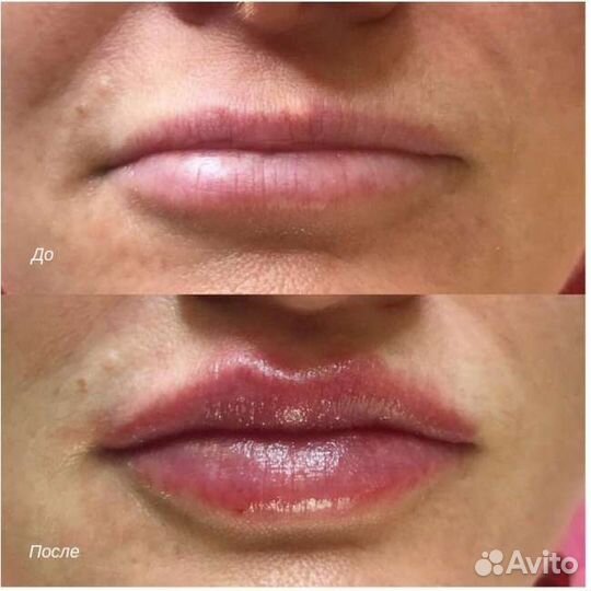 Маникюр, педикюр, ресницы, массаж