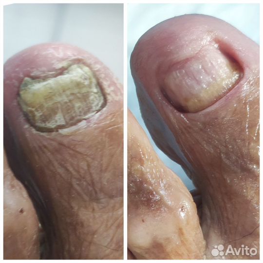 Услуги подолога