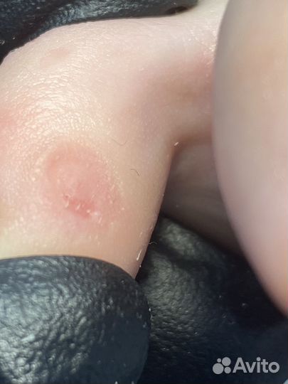 Педикюр подология