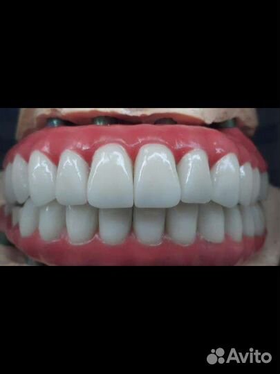 Съёмные/зубные протезы,коронки на зуб