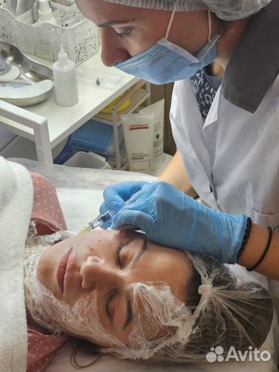 Игольчатый RF радиочастотный лифтинг, косметология