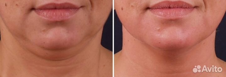 Консультация косметолога