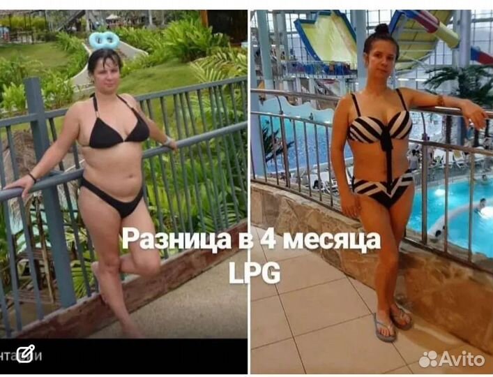 Массаж / кавитация / липосакция / массаж лица