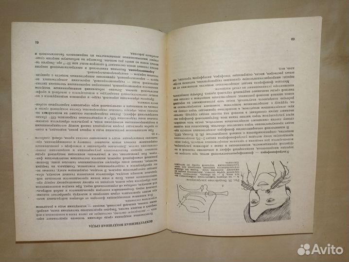 Справочник по физиотерапии лор. Цыганов, 1981
