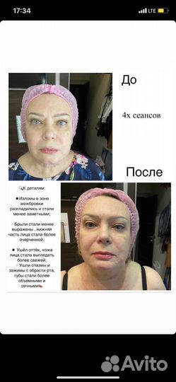 Массаж лица