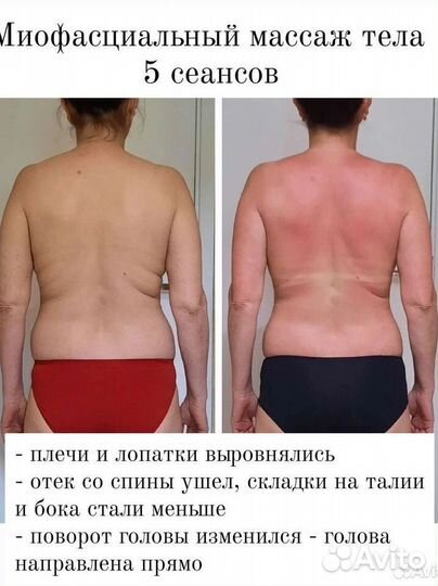 Массаж тела и лица