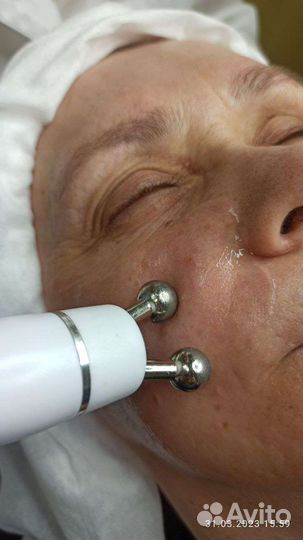 RF-лифтинг, Вакуумный массаж лица