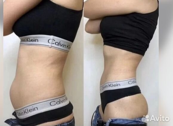 Плоский живот за 1 процедуру