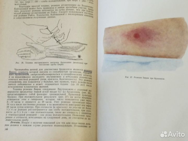 Книга, мед.учебник Курс инфекционных болезней