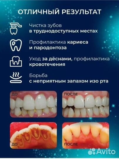 Щетка зубная электрическая скалер новая