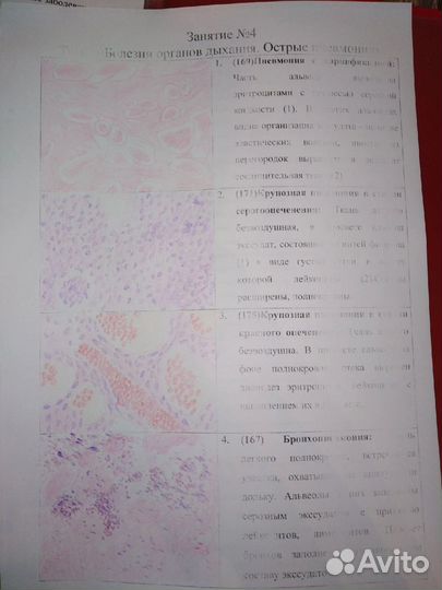Перепишу от руки лекции