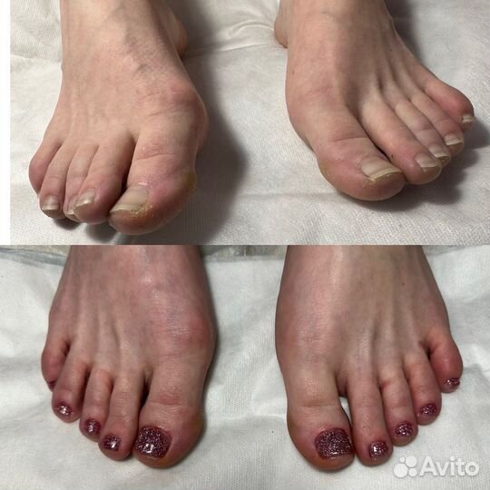 Модель на маникюр,педикюр