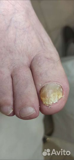 Подолог, педикюр, маникюр, эпиляция