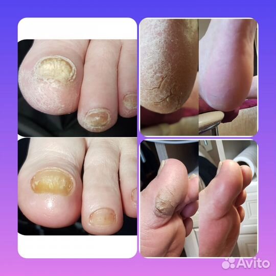 Педикюр Маникюр