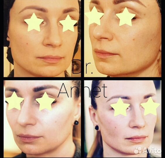 Врач косметолог