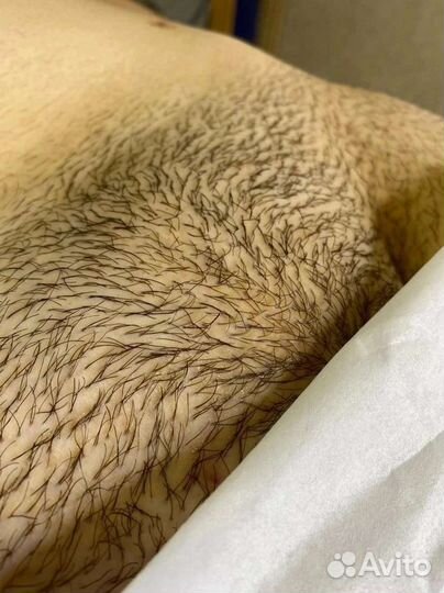 Восковая и сахарная депиляция