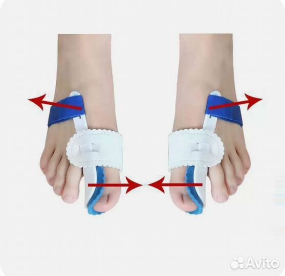 Корректор кости большого пальца