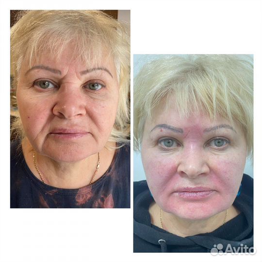 Услуги косметолога
