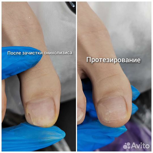 Подолог с выездом на дом