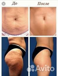 Коррекция фигуры, обертывания, лазерная эпиляция