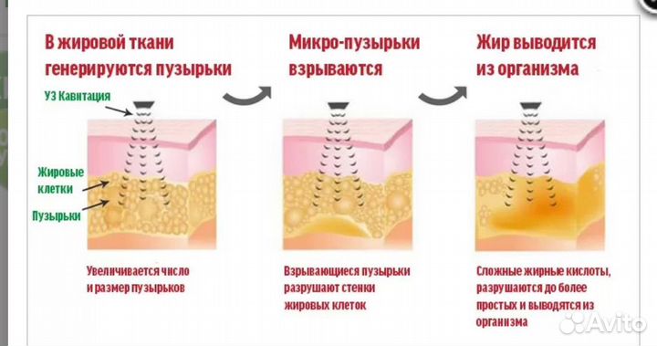 Аппарат для тела и лица