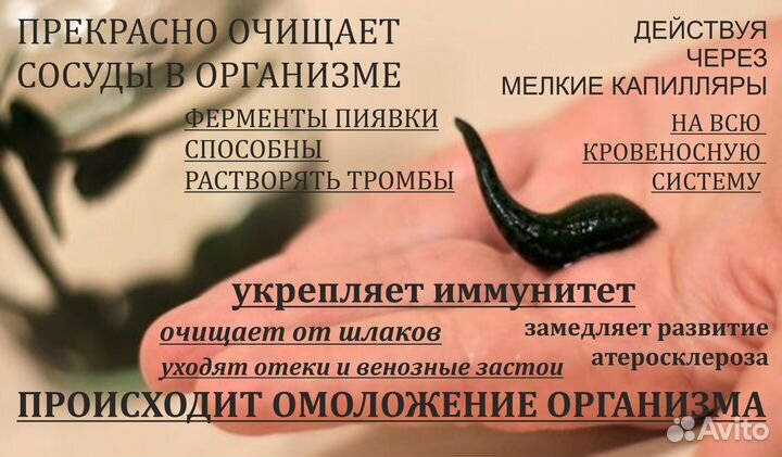 Купон на сеанс Гирудотерапии/ Косметологии