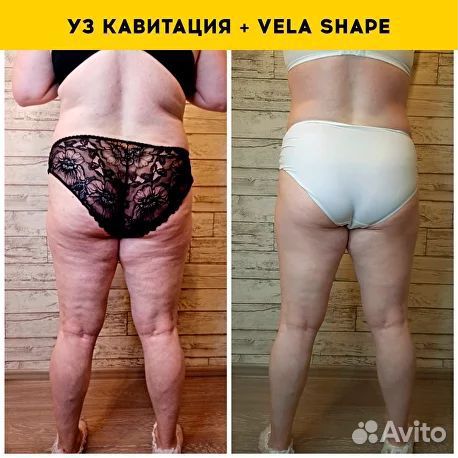 Массаж / СПА процедуры бесплатно