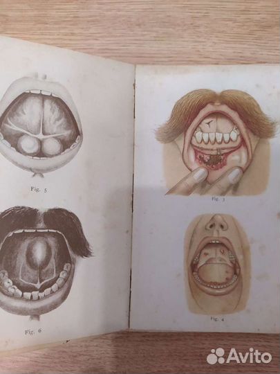 Антикварная медицинская книга