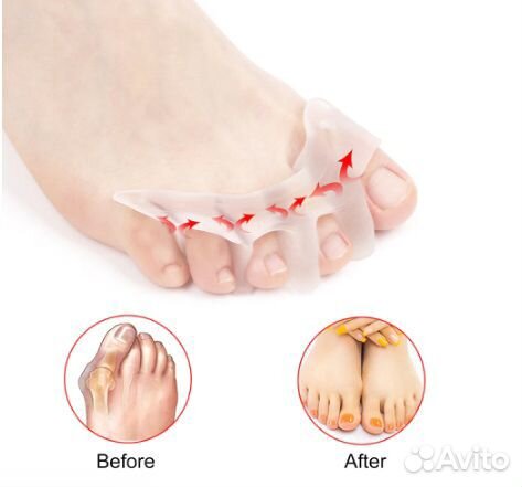 Корректор пальцев ног