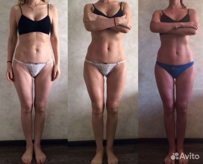 Vela Shape RF курс Безлимит летний