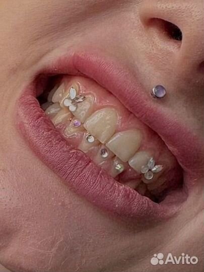 Скайсы / твинклы/ страз на зуб / tooth gems