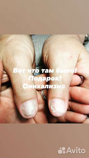 Препаратный педикюр