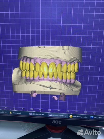 Exocad программа 3.1 Оригинал