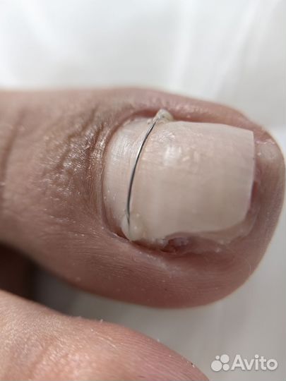 Услуги подолога