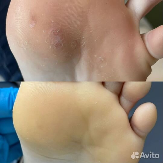 Услуги Подолога 49-39-29