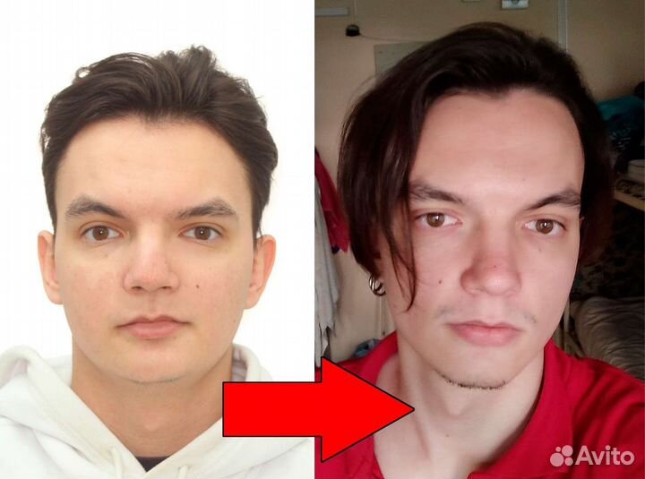 Консультация диетолога