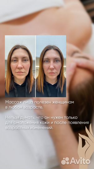 Буккальный массаж лица