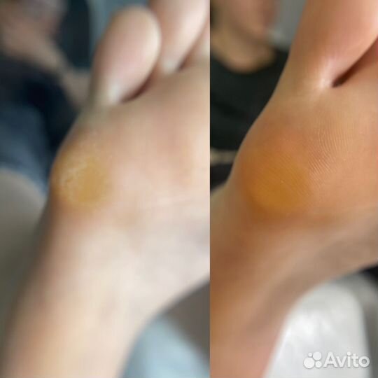 Модели на педикюр