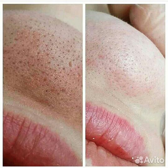 Расцветай С Perfekt body