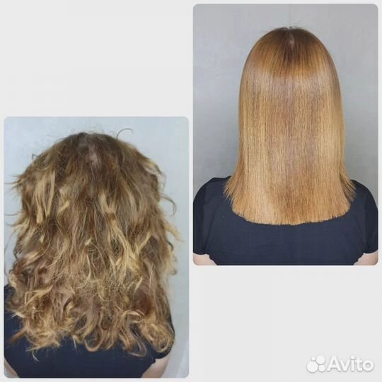 Ботокс-биксипластия