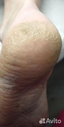 Педикюр с выездом