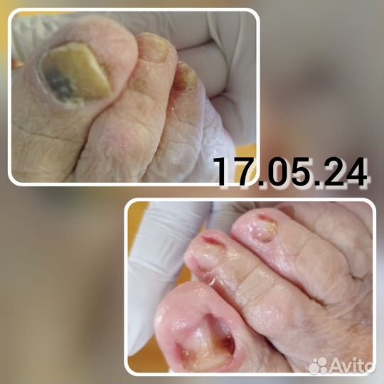 Педикюр-подолог, маникюр, депиляция, брови