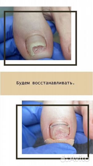 Маникюр, педикюр, подолог, косметолог,перманент