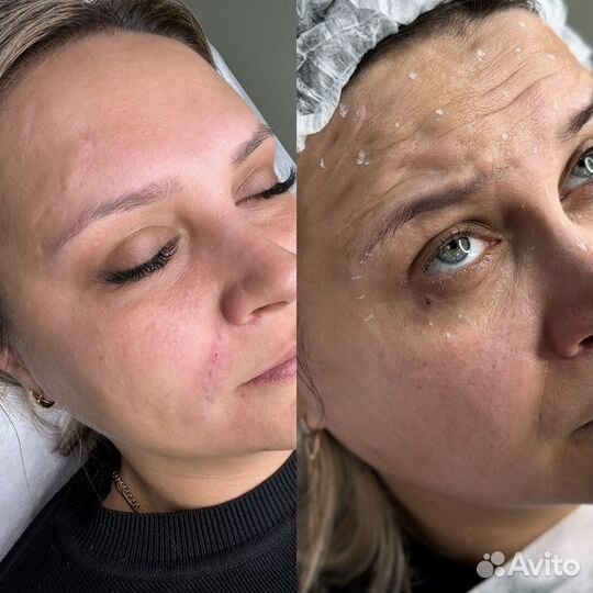 Модели губы