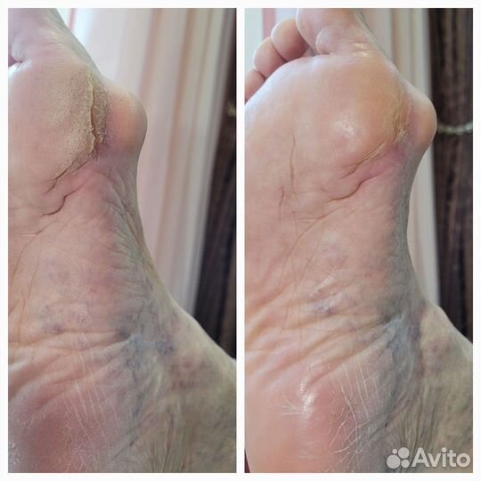 Требуются модели Маникюр SMART педикюр на дому