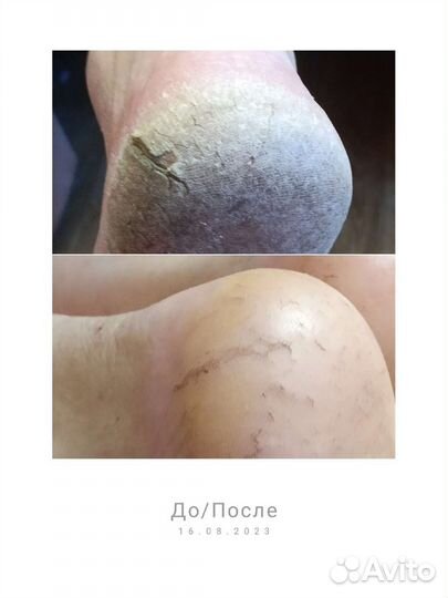 Чистые пяточки