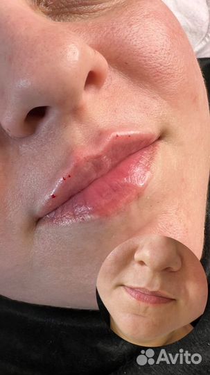 Услуги косметолога